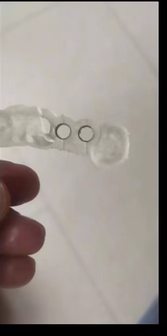 Resin Dental 3D Printer Planti - Glue For 3D Printing 评论和价格